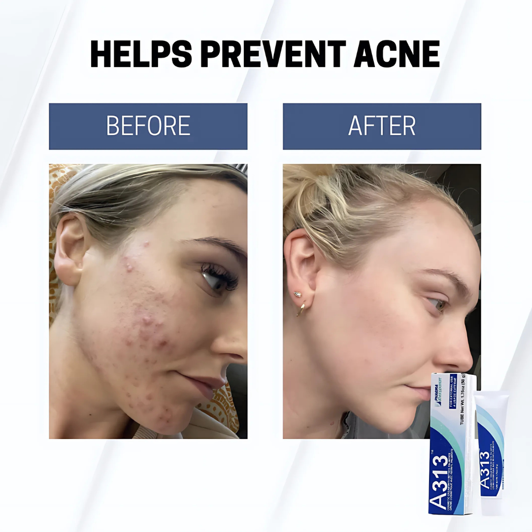 A313 - Vitamin A & Retinol Cream